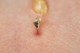 Un nouveau vaccin contre les allergies aux piqûres d'abeilles à l'essai