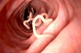 Ténia : on a identifié les cellules souches lui permettant de se régénérer 