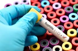 La recrudescence des cas de syphilis s’accompagne de symptômes inhabituels aux USA