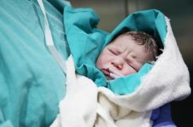 Les enfants nés par césarienne ont un risque accru de surpoids un an plus tard