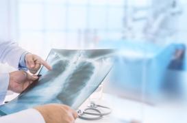 Décès de Guillaume Bats : qu’est-ce que la maladie des os de verre ?