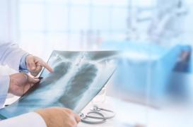 Il pensait avoir un cancer : c'était un jouet coincé dans son poumon !