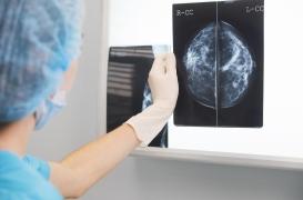 Cancer du sein : cette IA permet d'avoir un diagnostic dans la journée