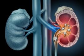 Le réchauffement climatique est responsable de 7,4% des maladies rénales