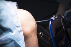 Déchirure du ménisque : l’arthroscopie est réalisée beaucoup trop souvent 