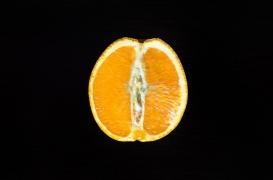 Chirurgie esthétique : de plus en plus de femmes recourent à un rajeunissement vaginal