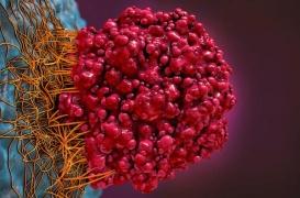 Androcur : les tumeurs du cerveau et le scandale des prescriptions hors AMM