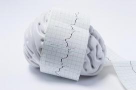 Epilepsie : la peur des discriminations professionnelles reste forte