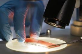 Journée mondiale de l'hémophilie : une maladie héréditaire encore méconnue