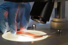 Cancer du sang récidivant : un nouveau médicament testé sur l'Homme suscite l'espoir