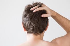 Un traitement contre une maladie rare modifie la couleur des cheveux