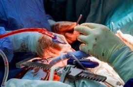 Greffe de poumon chez un patient Covid-19 : une première en France