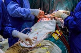 Coronavirus : aux Etats-Unis, une double greffe des poumons sauve une jeune patiente 