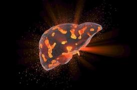 Cirrhose du foie : la promesse d’un nouveau traitement