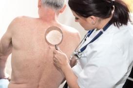 Un traitement réduirait de 75% les risques de cancer de la peau