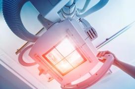 Cancer du sein : la radiothérapie peut abîmer le cœur