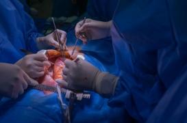 Covid-19 :  moins de chirurgies cardiaques depuis l'arrivée de la pandémie 