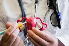 Cancer de l’ovaire : comment les tumeurs échappent à l’immunothérapie