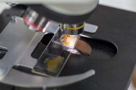 Cancer colorectal : ce nouveau test peut-il permettre d’éviter la coloscopie ?