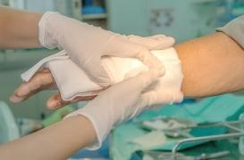 Grand brûlé : un pansement fait à partir de vers marins sauve un patient 