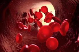 Symptômes et causes : qu'est-ce que la maladie de Vaquez ?