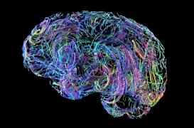 Alzheimer : le défaut de nettoyage des cellules cérébrales est au cœur du problème