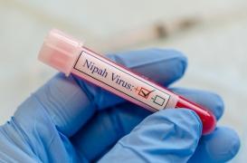 Nipah : un adolescent de 14 ans décède du virus en Inde