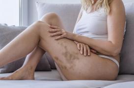 Violences conjugales : ces médecins qui veulent devenir une “personne ressource” pour les victimes 