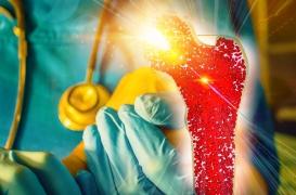 Cancer incurable de la moelle osseuse : l'espoir d'un nouveau traitement