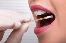 Cancer de la bouche : bientôt un dépistage salivaire en une heure ?