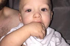 Cancer de la rétine : une photo permet de le détecter sur un bébé