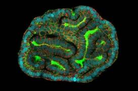 Des mini-organes créés à partir de cellules du liquide amniotique 
