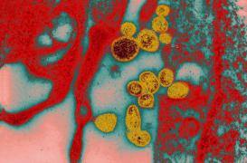 Fièvre de Lassa : 44 décès depuis novembre au Nigéria