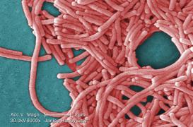 Légionellose : décès d'un patient à Montpellier 