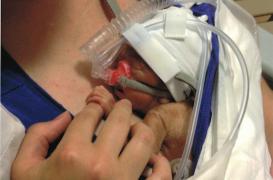 Prématurité : la carte postale choc a convaincu 20 députés