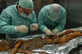 La momie glaciaire Ötzi souffrait d’une infection à l’estomac