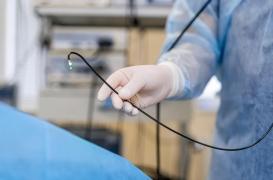 Cancer colorectal : la coloscopie n'aiderait pas à réduire les décès