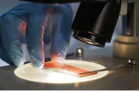 Cancer de la prostate : un nouveau test plus efficace et moins cher pour le détecter 