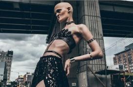 Melanie Gaydos : sa maladie génétique l'aide à devenir mannequin