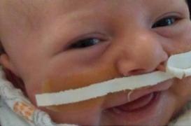 Herpès : un nourrisson de huit jours succombe au «baiser de la mort»