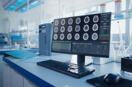 Covid-19 : Les lésions cérébrales, causes 