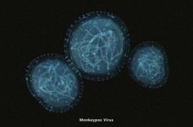 Variole du singe : quelle est la situation en France ? 
