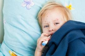 Rougeole : les Américains invités à se vacciner avant d’aller en Italie