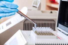 VIH : un super lymphocyte limite l'infection