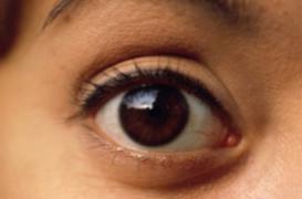 Produit ophtalmique suspect : deux Français ont perdu l'usage d'un oeil