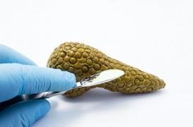 Diabète : des avancées dans la greffe de cellules pancréatiques 