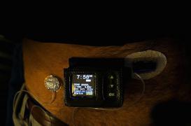 Diabète : le pancréas artificiel confirme son efficacité