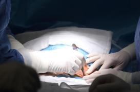 Qu'est-ce qu'une laparotomie, l'intervention que va subir le pape François ?