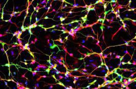 Parkinson : réparer les neurones avec des cellules de peau