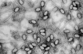 Antibiorésistance : sauvé d'une amputation grâce à la phagothérapie